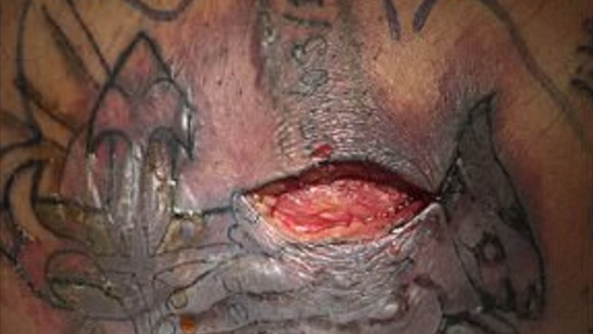 Herida en tatuaje recien hecho